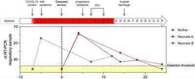 Case Report: Prolonged Neutropenia in Premature Monoamniotic Twins With SARS-CoV-2 Infection Acquired by Vertical Transmission